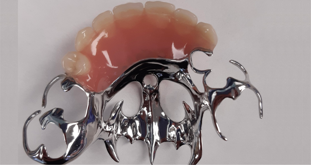 CHROME DENTURES PRIMELAB CHROME DENTURES PRIMELAB